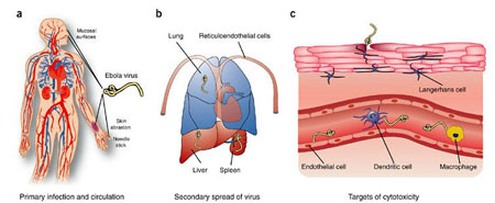 معرفی بیماری ابولا و علایم آن ابولا,بیماری ابولا