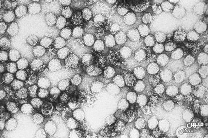 تب زرد تب زرد