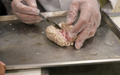 کلاس تشریح مغز